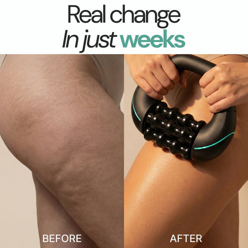 Acotin  Rollshaper